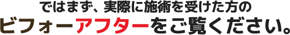 ではまず、実際に施術を受けた方のビフォーアフターをご覧ください。